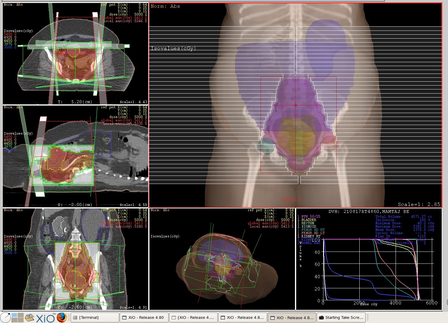 Three-Dimensional (3D) Conformal Radiation Therapy – Dr. Saurabha Kumar
